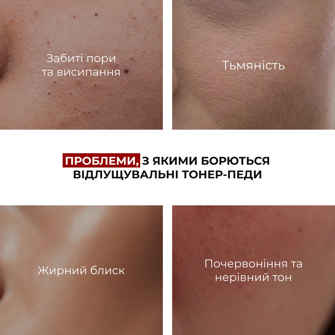 Комплекс пептидного омоложения Hillary Collagen & Peptide набор для кожи с возрастными изменениями лифтинг коррекция морщин