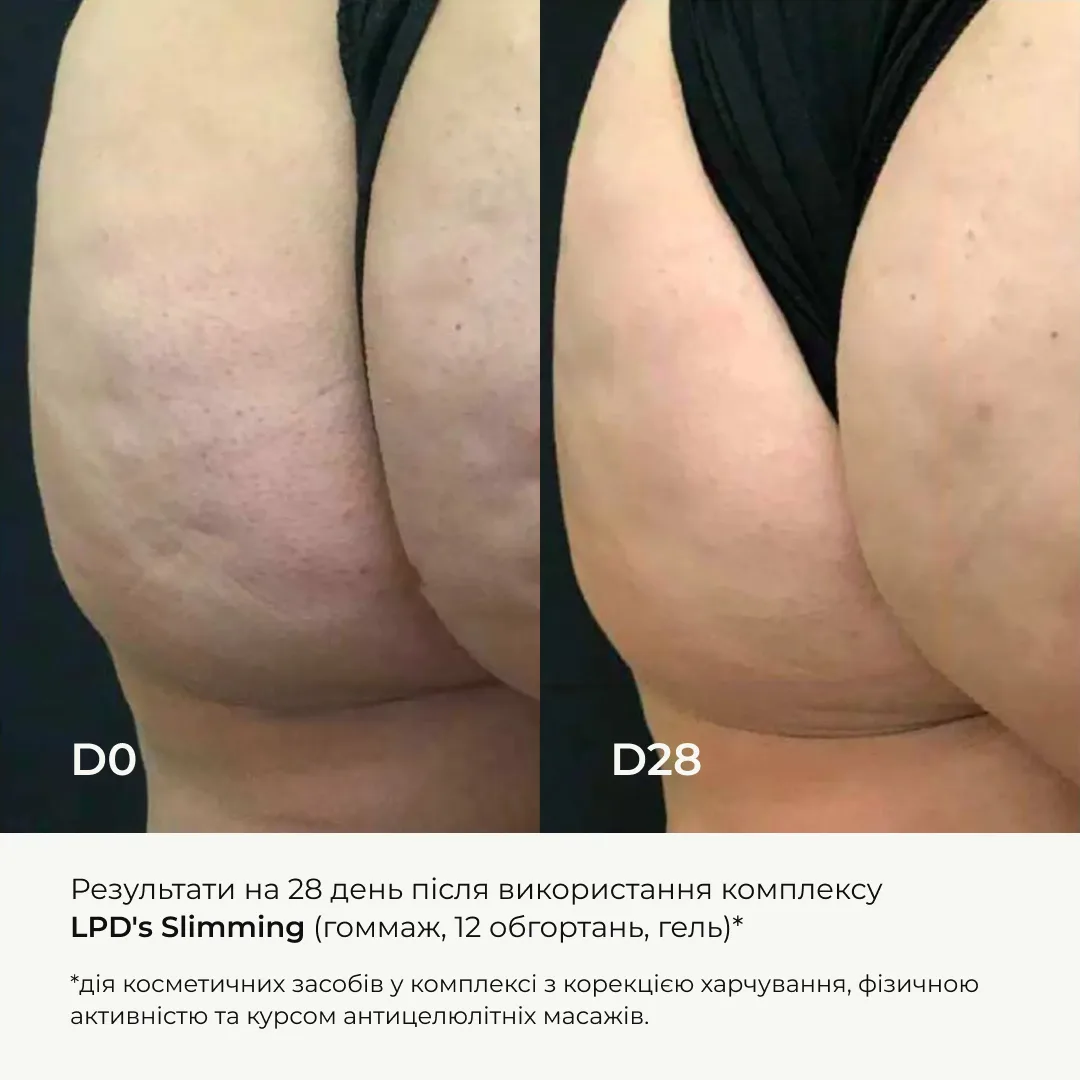 Курс для антицелюлітного догляду в домашніх умовах з активним ліпосомальним антицелюлітним комплексом Hillary